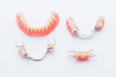 Napa Dental | Dentures, Dental Bridges and Oral Cancer Screening