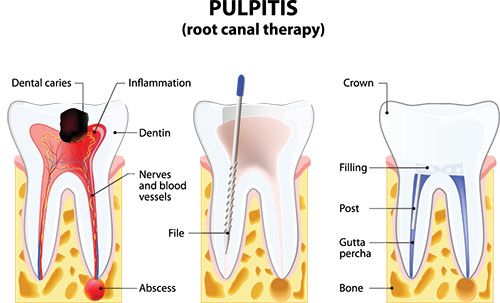 Napa Dental | Extractions, Cosmetic Dentistry and Dental Bridges